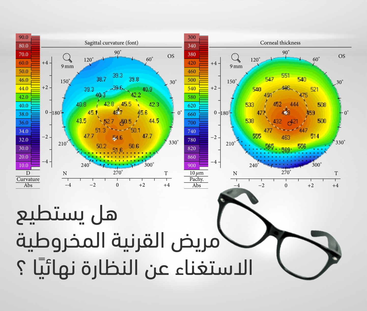 كيف يرى مريض القرنية المخروطية